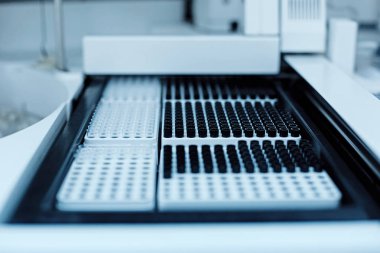 Masanın üzerinde yatan kutuyu açtın