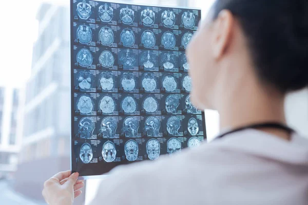 Oncologista experiente examinando a imagem de raios X na sala de roentgen — Fotografia de Stock