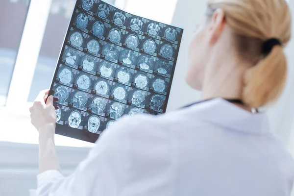 Залучений нейрохірург вивчає результати дослідження рентгенівського мозку в лабораторії — стокове фото