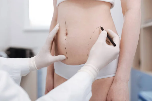 Surgeon consulting his patient on liposuction — Stock Photo, Image