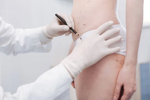 Specialist marking the guidelines for surgery — Stock Photo, Image