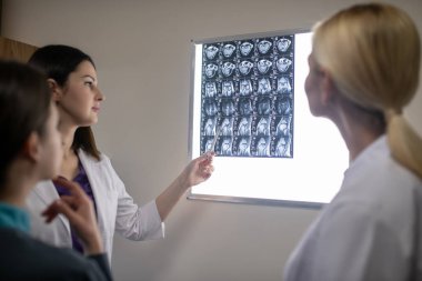 Nöroloji kliniğindeki doktorlar MRI taramasını tartışıyor