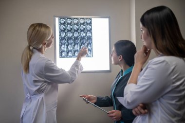 Sarışın doktor meslektaşlarına MRI taramasını gösteriyor.