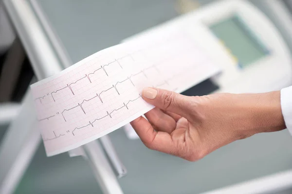 Närbild av läkare hand med elektrokardiogram resultat — Stockfoto