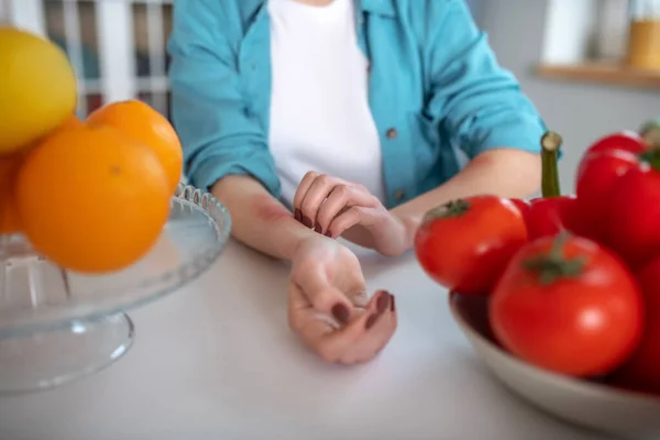 Mujer joven comiendo productos que causan una alergia — Foto de Stock