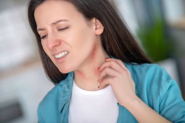 Woman having symptoms of allergy on her neck