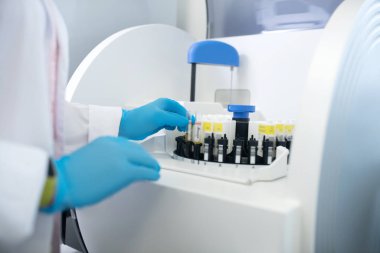 Close up of hands in sterile gloves taking the test tubes out of centrifuge