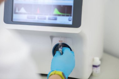Technician in blue gloves switching on hematological analyzer