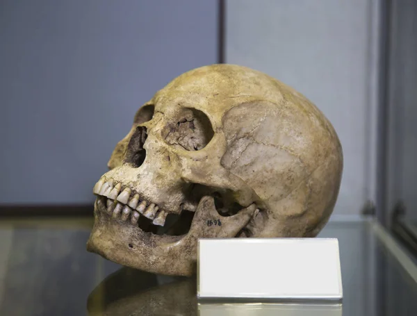 İnsan kafatası (Homo sapiens Linnaeus) belirgin bir kemik yapısı deseni ile gri renktedir ve yazı yazmak için bir yer kavramı kavramına sahiptir. Kemik bilimi, anatomi, paleontoloji.