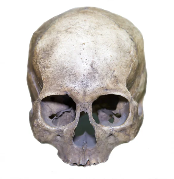Cranio Etiope Homo Sapiens Grigio Isolato Uno Sfondo Bianco Osteologia — Foto Stock