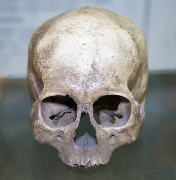 Crânio Etíope Homo Sapiens Sobre Fundo Cinzento Boneco Osteologia Anatomia — Fotografia de Stock