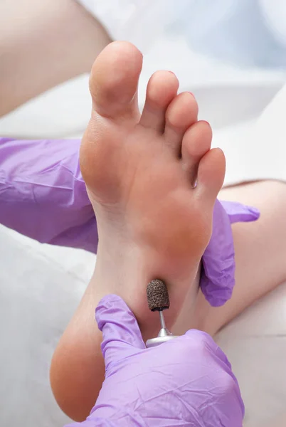 Процедура пилинга ног педикюром с элементарным устройством у кавалера — стоковое фото