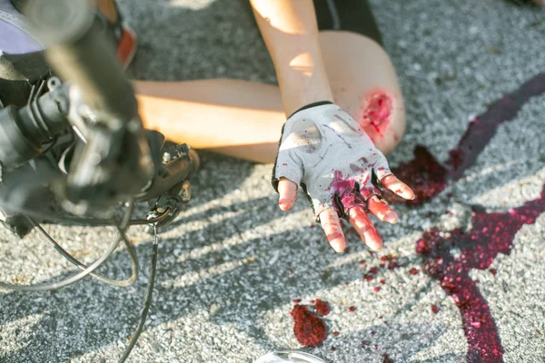 hand of cycling in hurt and injuried of leg after accident clashed, with wound and bleeding of blood flow on the surface of street road