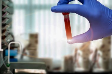 Laboratuvar testleri için elinde şırınga ve tüplerle kırmızı reaktif şırınga enjekte eden bilim adamı sonuçlandı. 