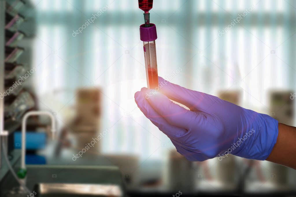 Diagnostician scientist injecting red reactive into tube,  syringe and tubes in hand holding in hand for lab testing resulted, covid testing lab vaccine 