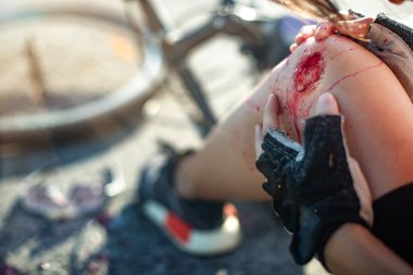 accident clashed on bicyclist in hurt and injured at knee of leg, after accident clashed, with wound and bleeding of blood flow on the of street road