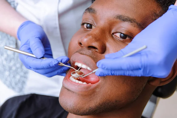 Paciente varón africano recibiendo tratamiento dental en clínica dental — Foto de Stock