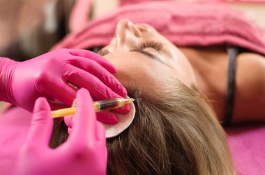 İğne mezoterapisi. Kadının kafasına kozmetik enjekte edilmiş. Saçlarını güçlendirmek ve uzamasını sağlamak için.