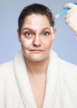Kendimi - Botox enjeksiyonu, genç eski Yenileniyor. 45 yaşındaki kadın, Botox enjeksiyonu Başlarken: sol taraf: yaşlı ve buruşuk, sağ tarafta: genç ve photoshopped
