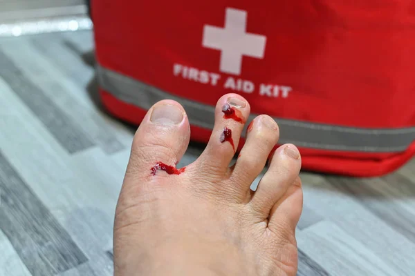 Blurred first aid bag with wound at foot from accident walking in an messy unorganized place — 스톡 사진