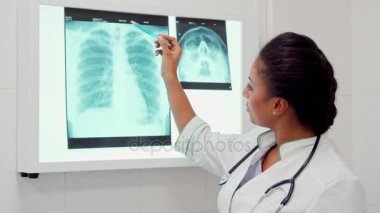 Kadın doktor Puan kalem x-ray görüntü üzerinde sırtta