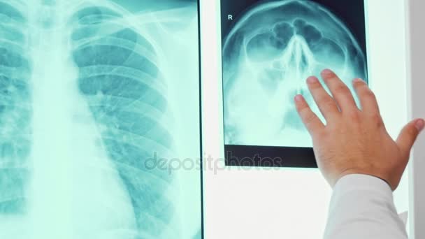 Mano maschile si muove sulla radiografia — Video Stock