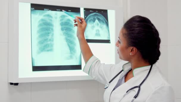 Femme médecin points stylo sur la colonne vertébrale sur l'image radiographique — Video