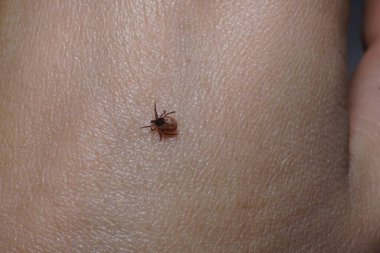 Dişi kenesi (Ixodes skapularis) ısırmaya hazır deri üzerinde sürünüyor 
