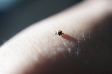 Dişi kenesi (Ixodes skapularis) ısırmaya hazır deri üzerinde sürünüyor 