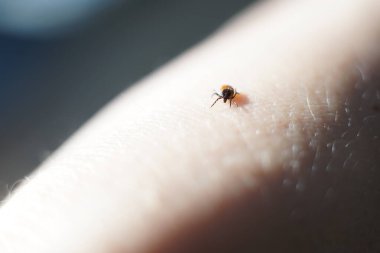 Dişi kenesi (Ixodes skapularis) ısırmaya hazır deri üzerinde sürünüyor 