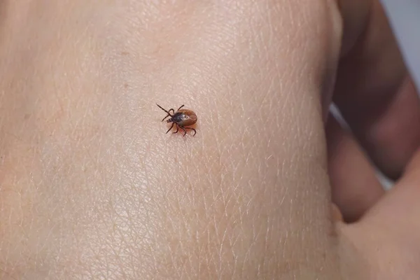 Female Tick Ixodes Scapularis Crawling Skin Ready Bite — Stock Photo, Image