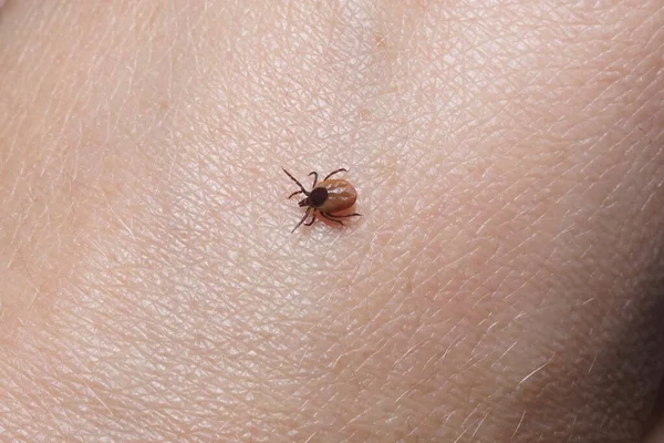 Female Tick Ixodes Scapularis Crawling Skin Ready Bite — Stock Photo, Image