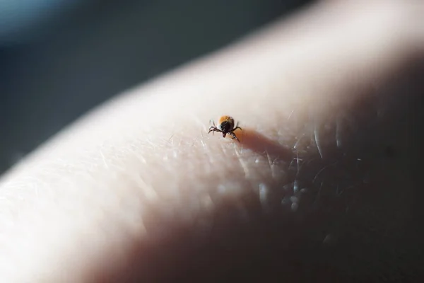 피부를 기어다니는 진드기 Ixodes Scapularis — 스톡 사진