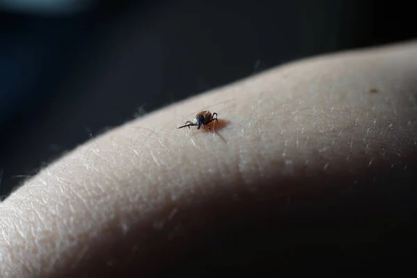 Θηλυκό Τσιμπούρι Ixodes Scapularis Σέρνεται Στο Δέρμα Έτοιμο Δαγκώσει — Φωτογραφία Αρχείου