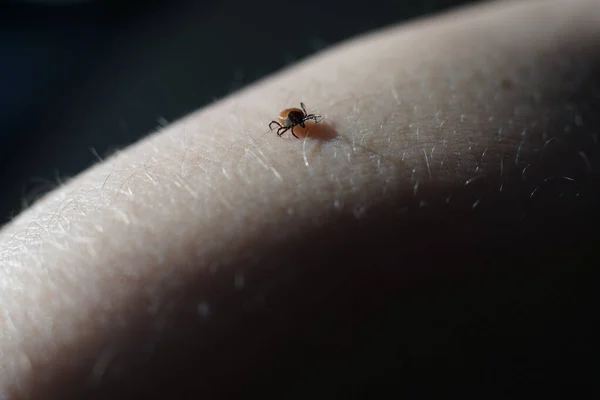 Carrapato Fêmea Ixodes Scapularis Rastejando Pele Pronto Para Morder — Fotografia de Stock