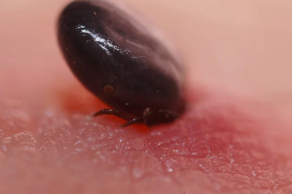 Super close up of sucking Ixodes ricinus on human skin. Adults feed on large mammals such as sheep, cattle, dogs, deer, humans, and horses for 613 days, before dropping off.