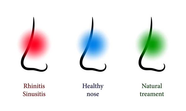 Otorhinolaryngology set with healthy and sick nose — Stock Vector