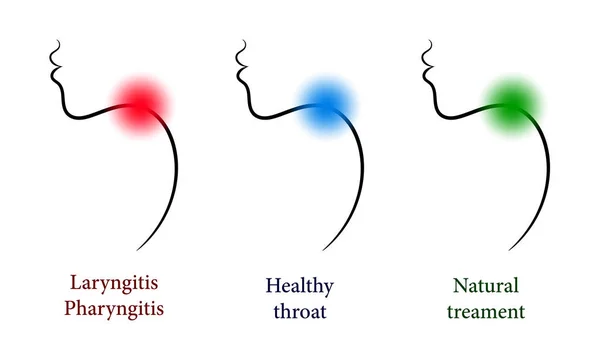 Otorhinolaryngology set ile sağlıklı ve boğaz — Stok Vektör