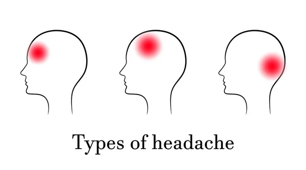 Types of headache, contour medical concept — Stock Vector