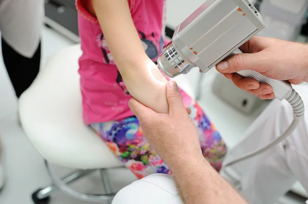 Diagnóstico de melanoma. o médico examina a toupeira pacientes — Fotografia de Stock