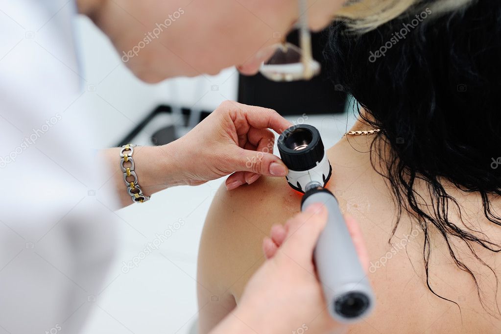 melanoma diagnosis. the doctor examines the patients mole