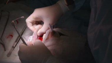 cerrah diş bir işlemi yapar