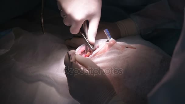 Il chirurgo effettua un'operazione dentistica — Video Stock