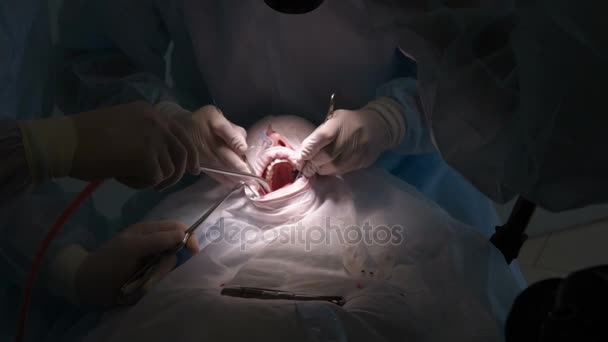 Kirurgen gör en dental operation — Stockvideo