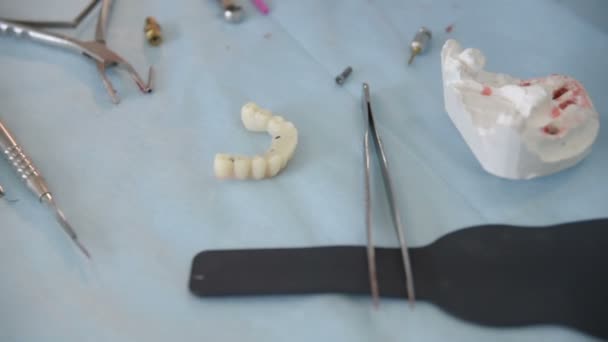 Een tandheelkundige indruk voor prothese — Stockvideo