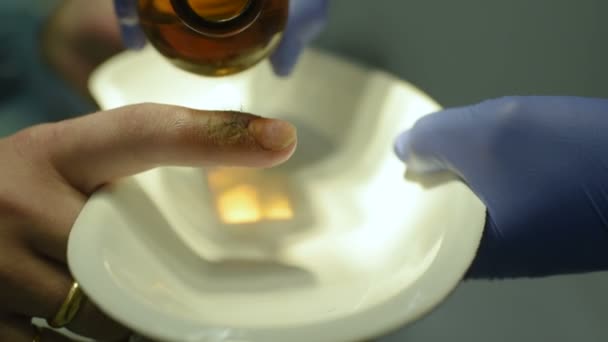 Behandeling van een wond aan de vinger met jodium en waterstofperoxide — Stockvideo