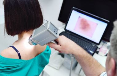 Doktor neoplazmlar veya mol hastaların deri inceliyor