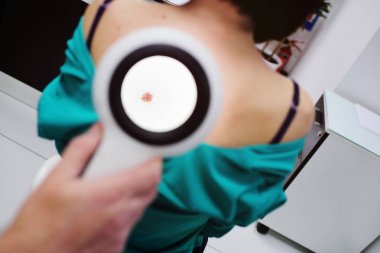 Dermatolog özel seçim Büyüteç yardımı ile hastaların benler inceliyor.