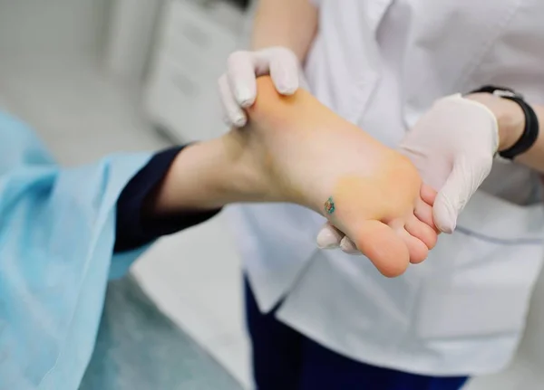 Bradavice na nohou pacientů — Stock fotografie