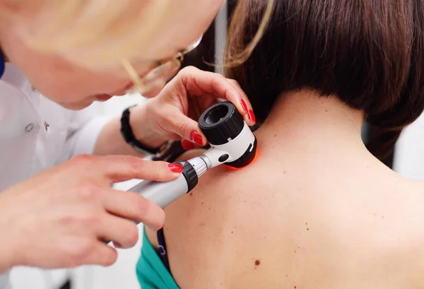 The dermatologist examines the moles or acne of the patient with a dermatoscope — Stock Photo, Image